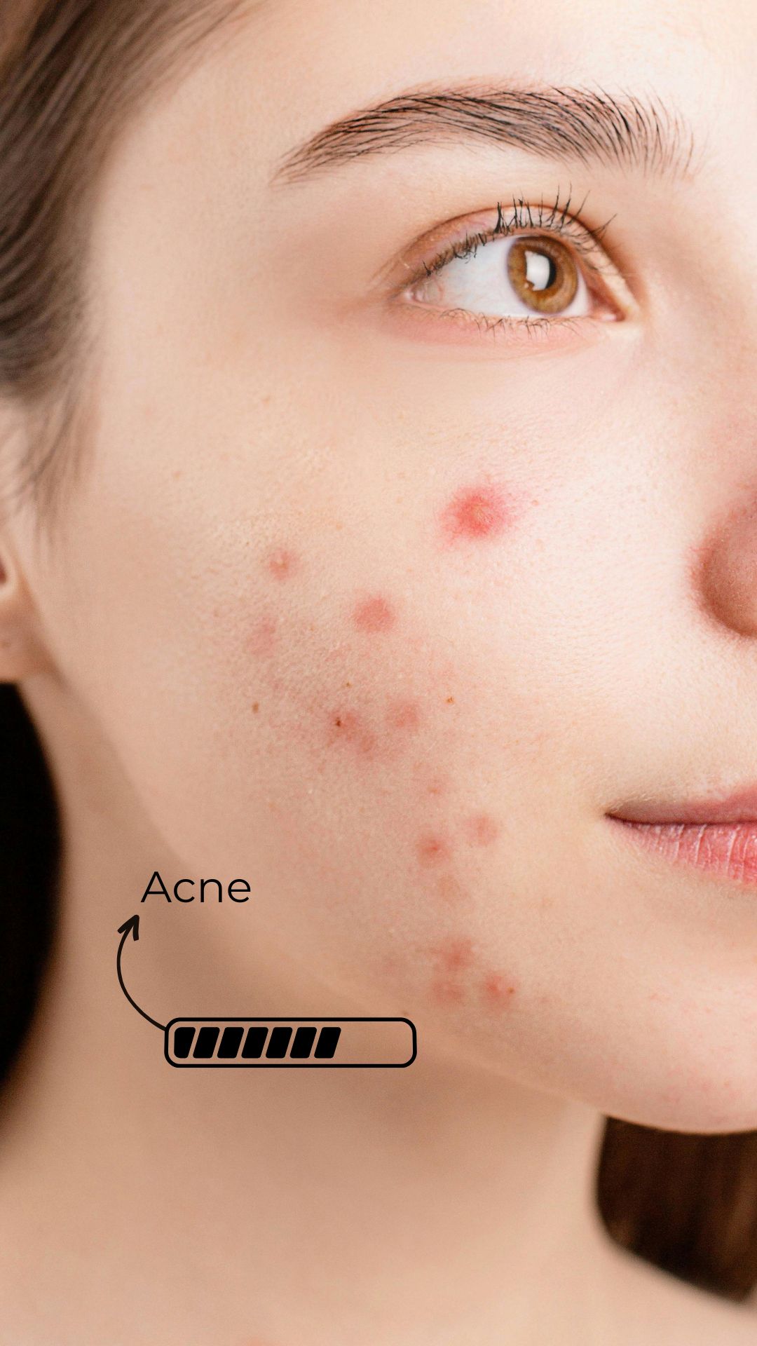 ANALYZES SKIN FEATURES - Feature 5