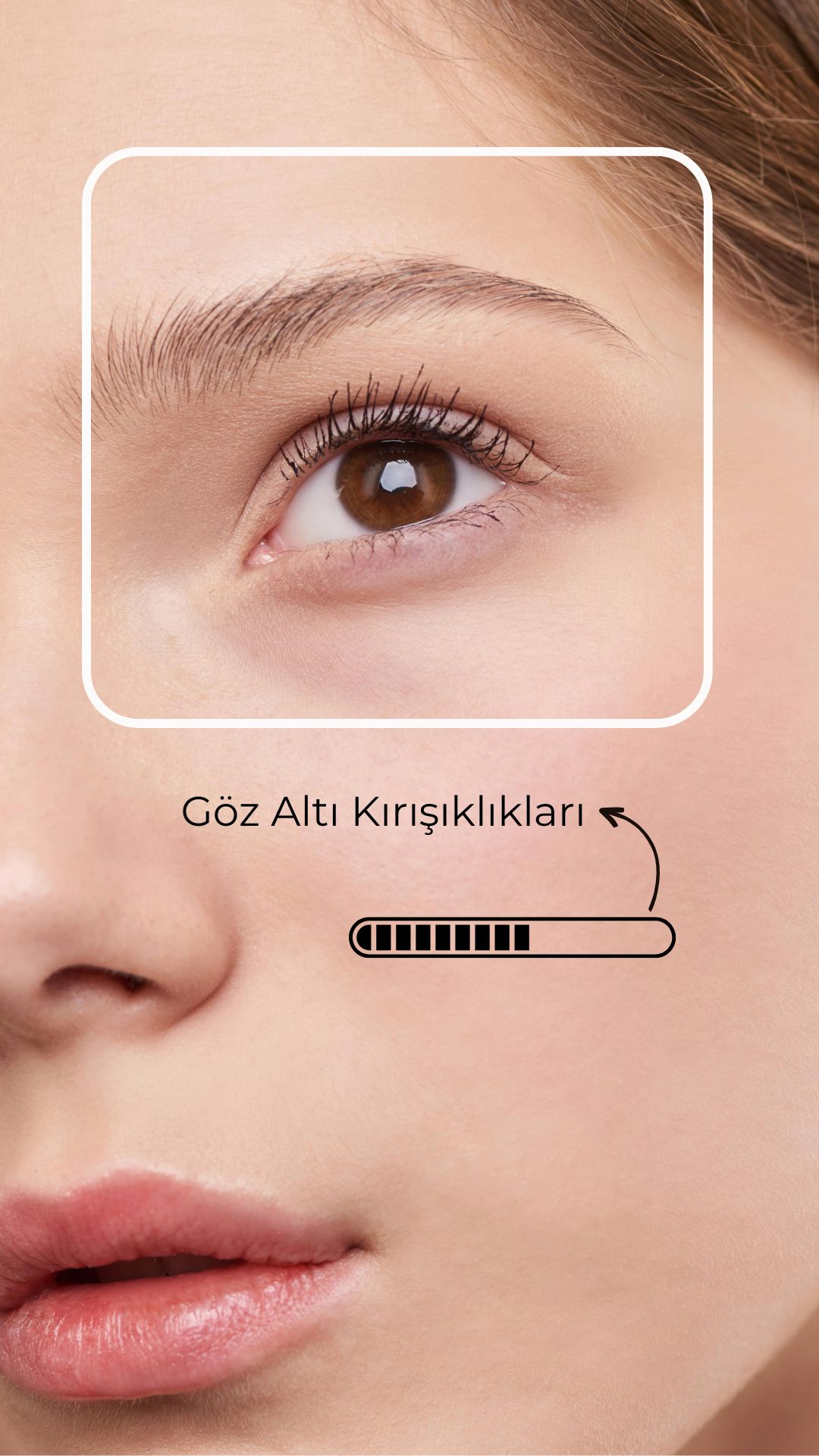 CİLT ÖZELLİĞİNİ ANALİZ EDER - Feature 2